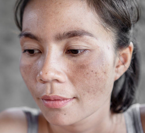 Femme avec masque de grossesse - Mustela Belgium - 1