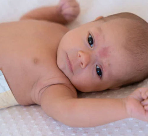 Wet wrapping : est-ce efficace contre l’eczéma de bébé ? - Mustela Belgium - 1