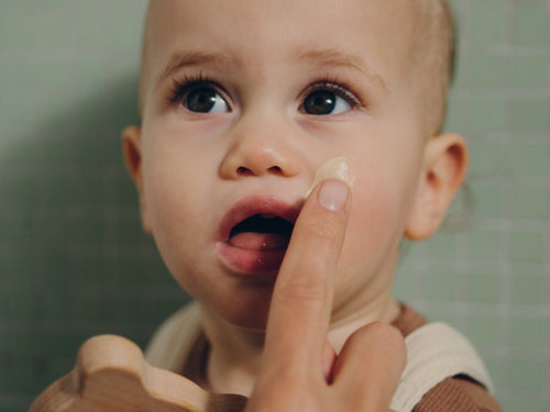 Application du Baume universel sur le visage d'un enfant ayant de l'eczéma - Mustela Benelux - 5